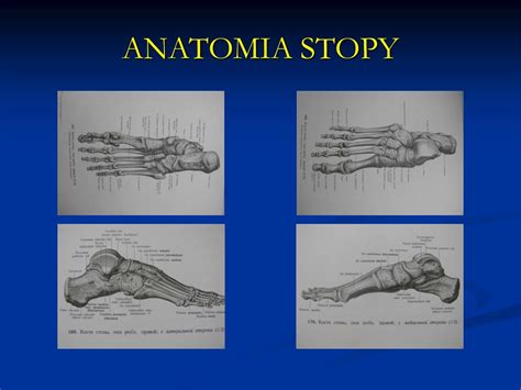 PPT WRODZONA STOPA KOŃSKO SZPOTAWA PES EQUINO VARUS CONGENITAL