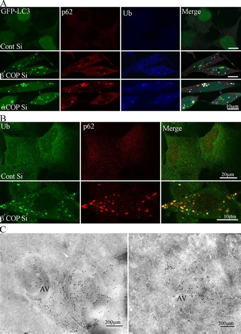 Ub And P Accumulate In And Copdepleted Gfp Lc Cells A