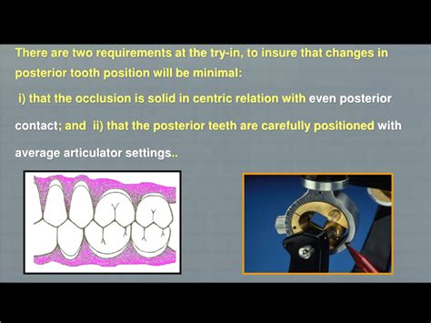 Ppt Try In Of Complete Denture Powerpoint Presentation Free Download Id9638087