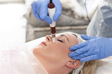 VTCT ITEC LEVEL 4 CERTIFICATE IN SKIN NEEDLING Younique Aesthetics