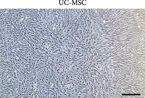 Characterization Of Umbilical Cord Mesenchymal Stem Cell Derived