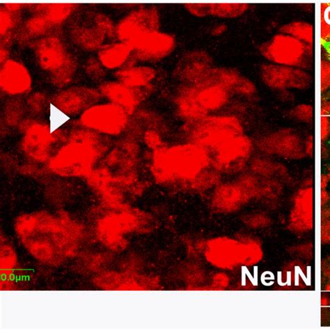 Confocal Images Showing Neuronal Differentiation Of Grafted Progenitor