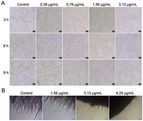 Ijms Free Full Text Anti Biofilm Activity Of Cocultimycin A Against