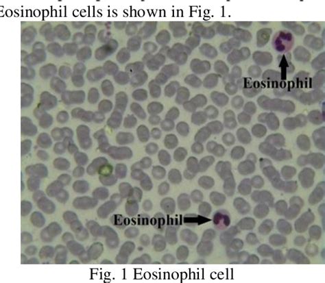 Figure 1 From An Absolute Eosinophil Count Test Using Digital Image