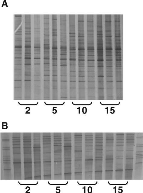 Polymerase Chain Reaction Denaturing Gradient Gel Electrophoresis Download Scientific Diagram