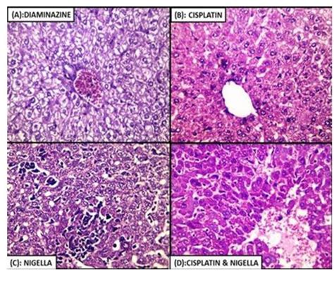 Histopathological Examination Of Liver Tissue From A Download Scientific Diagram