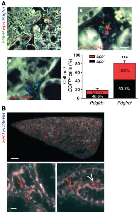 Differential Expression Of Pdgfrb In Murine And Human Epoproducing Download Scientific Diagram