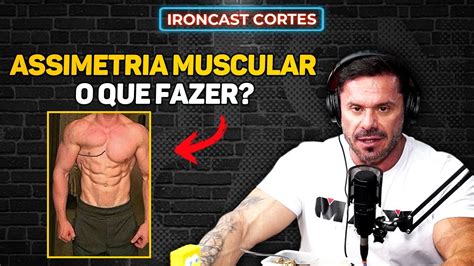 Como Tratar Uma Assimetria Muscular Cariani Explica Ironcast Cortes