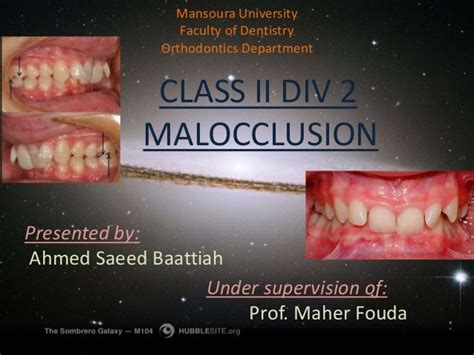 Class Ii Div 2 Malocclusion