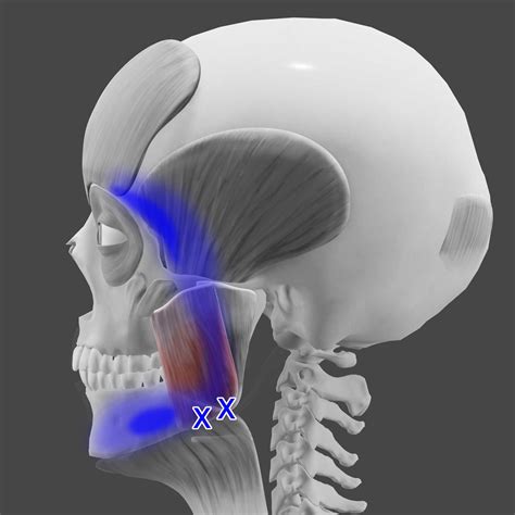 Masseter Muscle Pain Treatment — Morningside Acupuncture NYC