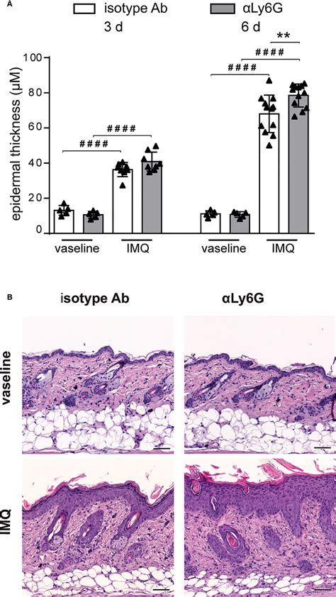 Frontiers Neutrophils inhibit γδ T cell functions in the imiquimod