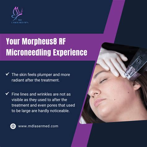 Plano Tx Morpheus8 Rf Microneedling Skin Treats And Experience