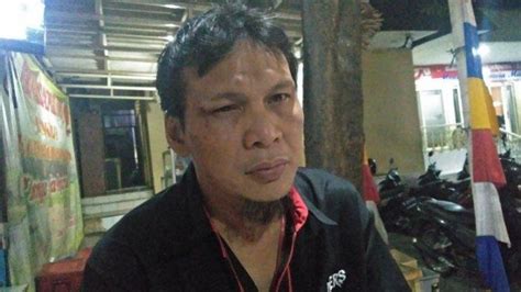 Wartawan Ini Pelipis Matanya Sobek Dan Kepalanya Bocor Dihajar Polisi