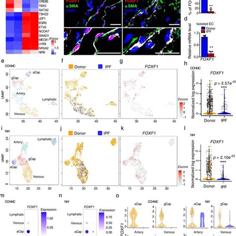 Foxf Is Decreased In Ecs Of Human Ipf Lung A Heat Map Shows Top