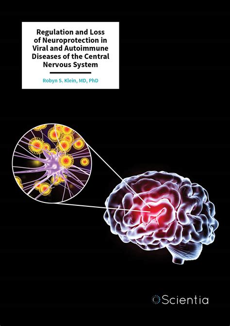 Dr Robyn S. Klein - Regulation and Loss of Neuroprotection in Viral and Autoimmune Diseases of ...