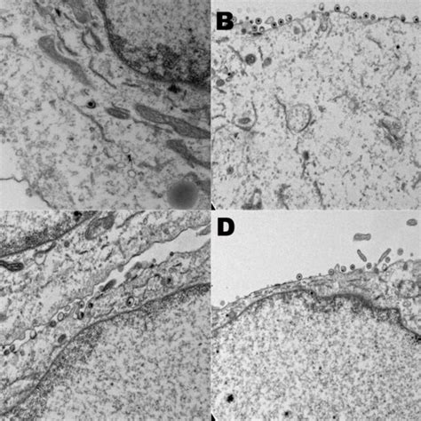 Electron Micrographs Of Wild Type And Recombinant Viruses Electron