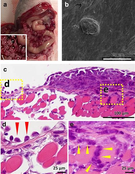 In Vivo Model Of Peritoneal Metastasis A 9 Days After HRA Cells Were