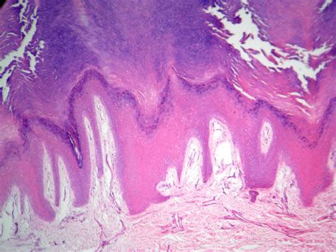 Atlas De Histologia Tecido Epitelial Estratificado Hot Sex Picture