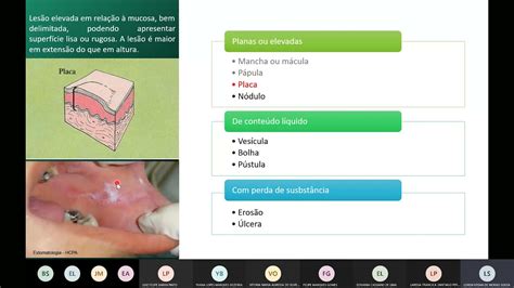 Aula 12 Lesões fundamentais em estomatologia laserterapia em