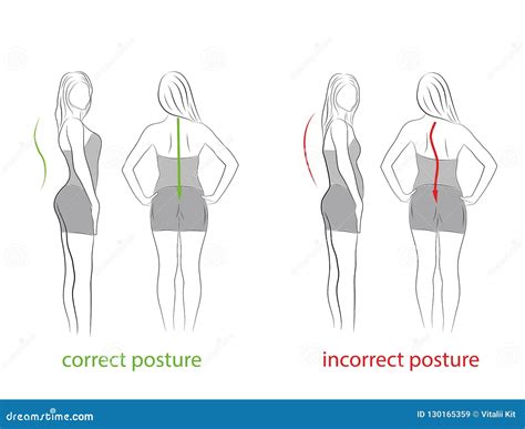 Postura Correcta E Incorrecta Lado Y Vista Posterior Recomendaciones