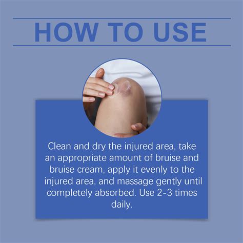 Bruising Treatment Cream Bruises Injury Swelling Pain Relief Cure