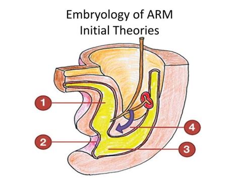 Anorectal Malformations Embryology Classification Diagnosis And