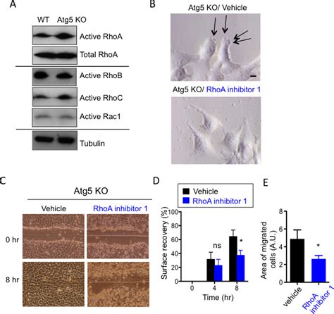 Involvement Of Rhoa In The Amoeba Like Migration Of Atg Ko Mefs A