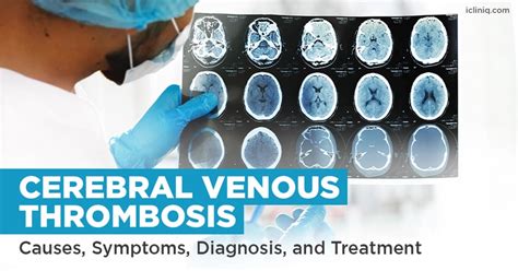 Venous Thrombosis Treatment