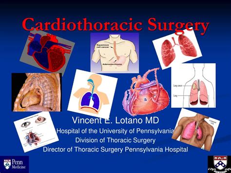 Ppt Cardiothoracic Surgery Powerpoint Presentation Free Download