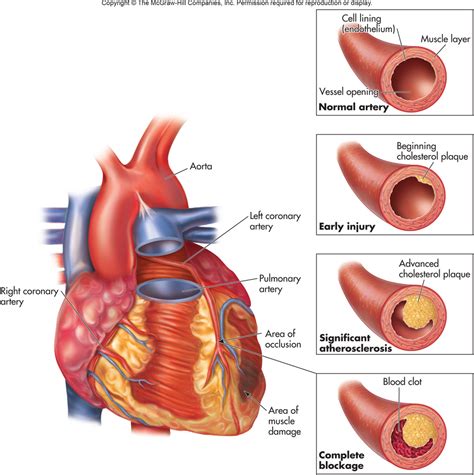 Diseases Of The Cardiovascular System I Diagram Quizlet