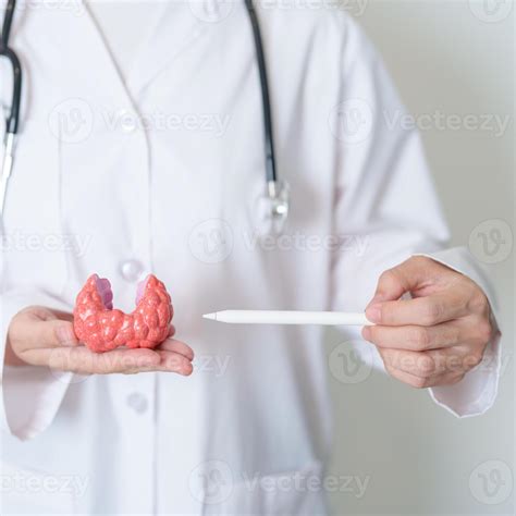 médico com humano tireoide anatomia modelo. hipertireoidismo, hipotireoidismo, hashimoto