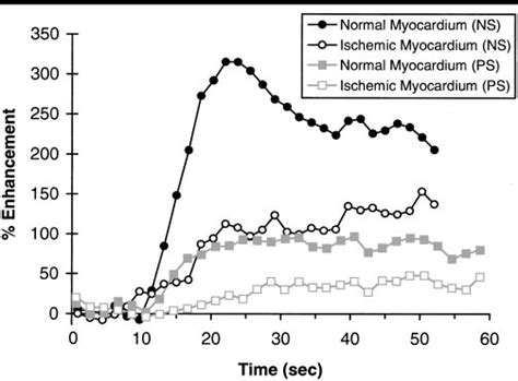 Line Graph Presents The Percentage Contrast Enhancement Versus Time For