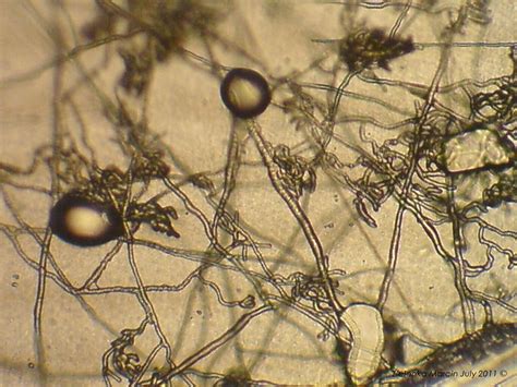 Pythium Spp Micomuc Flickr