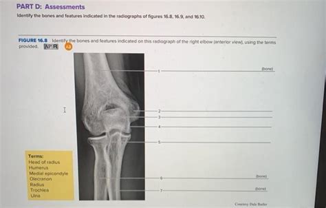 Solved Part D Assessments Identify The Bones And Features Chegg