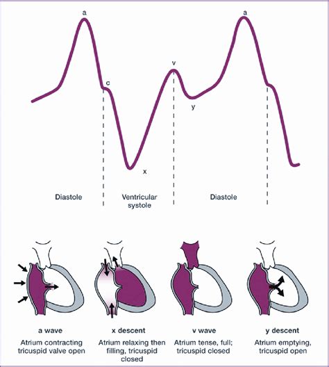 How To Calculate Cvp Medical