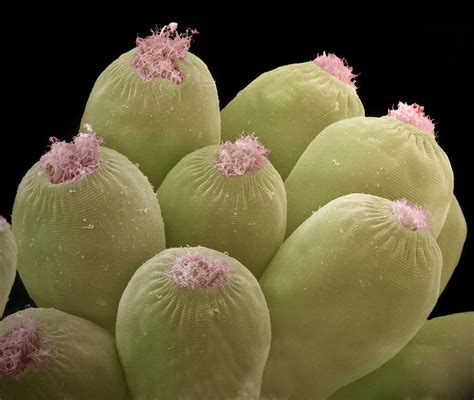 Ciliate Protozoans, Sem Photograph by Steve Gschmeissner - Fine Art America