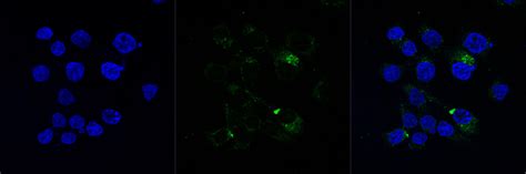 584 questions with answers in FLUORESCENCE MICROSCOPY | Scientific method 