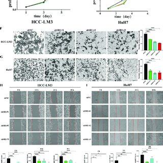 Knockdown Sorcin Inhibited Hcc Cell Proliferation Migration And