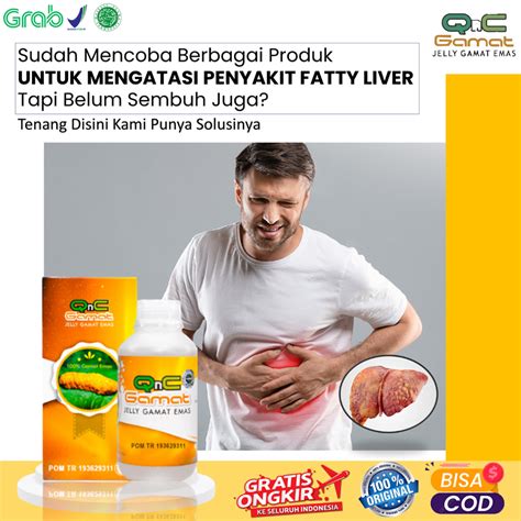 Jual Obat Herbal Liver Bengkak Fatty Liver Gangguan Fungsi Hati