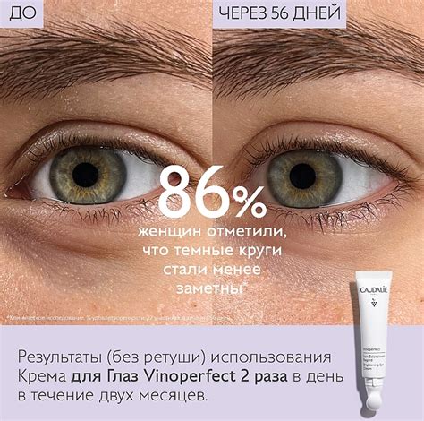 Caudalie Vinoperfect Brightening Eye Cream - Осветляющий крем для кожи ...