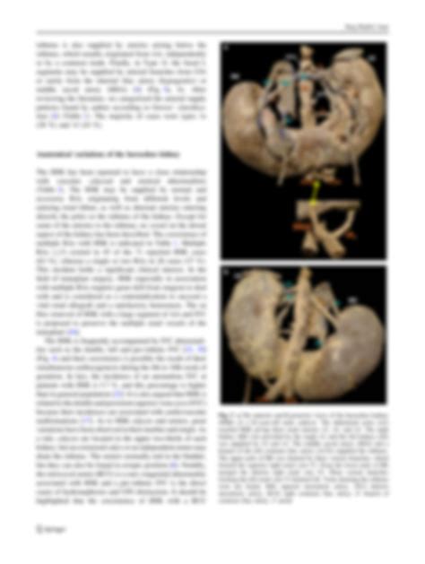 SOLUTION: Horseshoe kidney a review of anatomy and pathology - Studypool