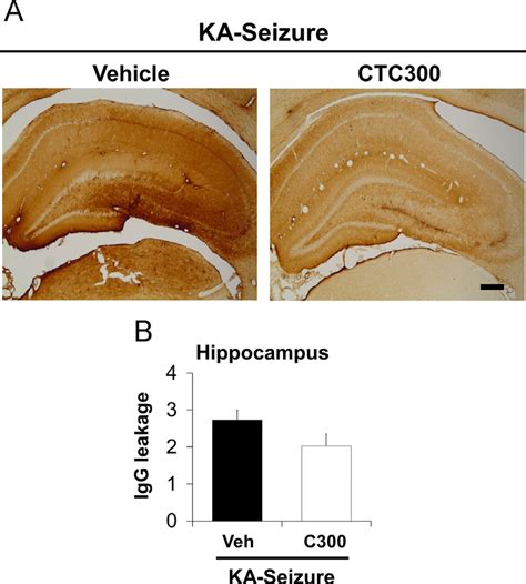 Kainate Seizure Induced Blood Brain Barrier Bbb Damage Is Not