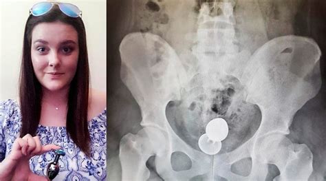 A Punto De Morir Por Culpa De Un Juguete Sexual Anal Estarguapas