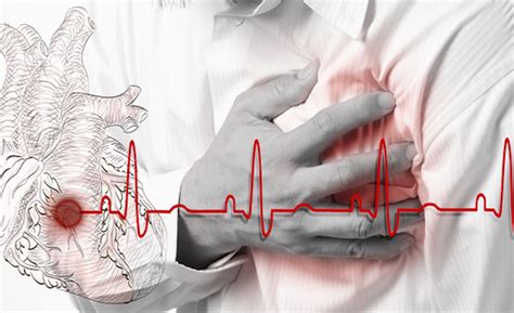 Parada Cardiorrespiratória O Que É - O Que É Parada Cardiorrespiratória? - Enfermagem Florence