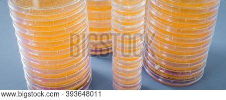 Pile Petri Dish Image Photo Free Trial Bigstock