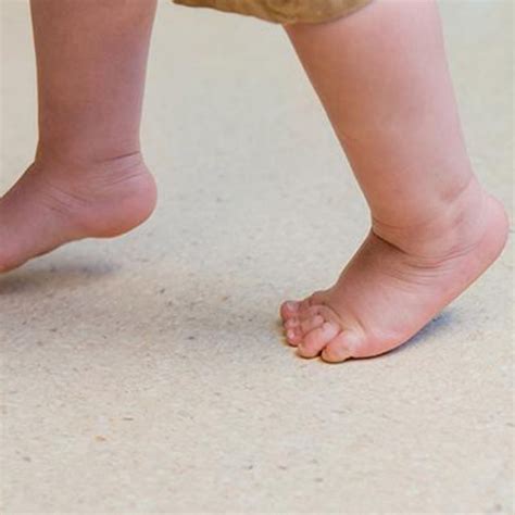 Idiopathic Toe Walking In Kids Surestep