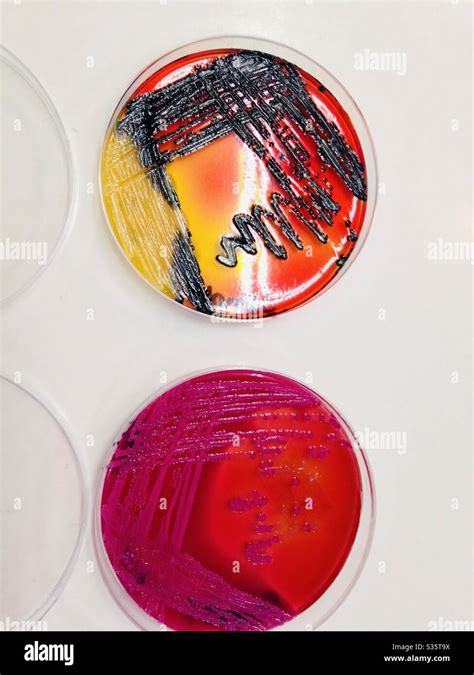 Salmonella Typhi Culture