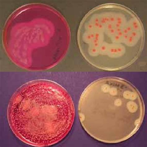 Colonies Of B Cereus Grown On MYP Are Pink And Lecithinase Positive