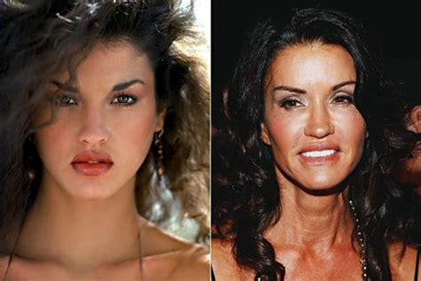 Worst Cases Of Celebrity Plastic Surgery Gone Wrong