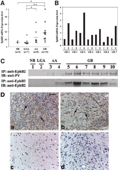 Ephb Expression Phosphorylation And Localization In Various Human